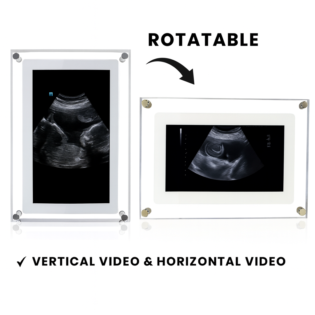 CozyPal Digital Frame